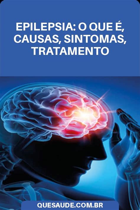 Epilepsia Sinais E Sintomas