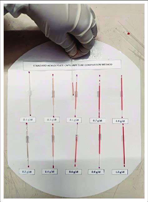 Standard haemolysate capillary tube comparison method developed at the ...