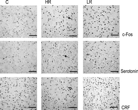 Photomicrographs Showing Representative Expression Of C Fos Crf And