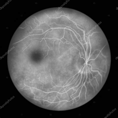 Retina Ocular Normal Ilustraci N Cient Fica Que Muestra Disco Ptico