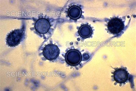 Histoplasma Capsulatum | Stock Image - Science Source Images