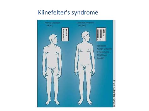 Puberty Disorders PPT