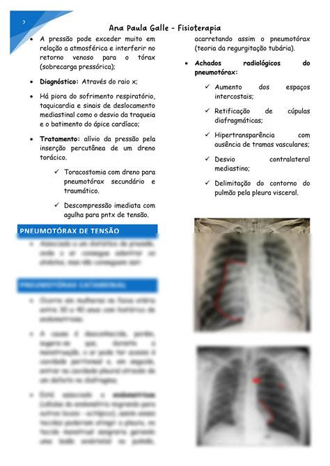 Solution Pneumot Rax Ana Galle Studypool