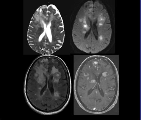 Question 52 MRI Online