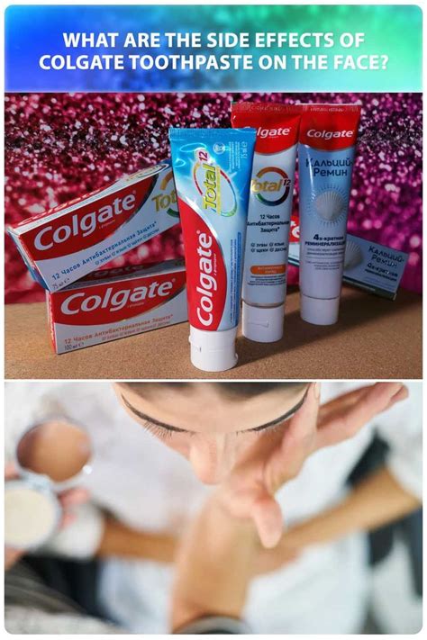 Which Toothpaste Is Best For Pimples Artofit