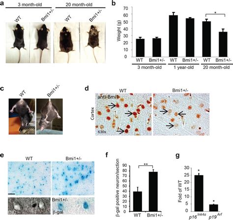 Bmi Mice Present Accelerated Aging Features And Neurological