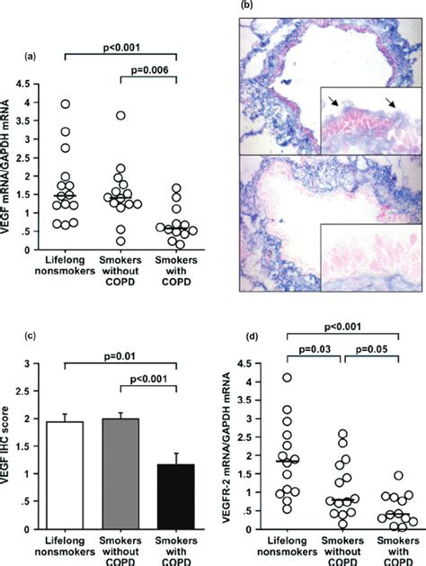 Vegf And Vegfr Expressions In Human Bronchiolar Epithelial Cells A