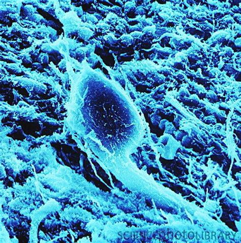 Purkinje Nerve Cell From The Cerebellum Of The Human Brain