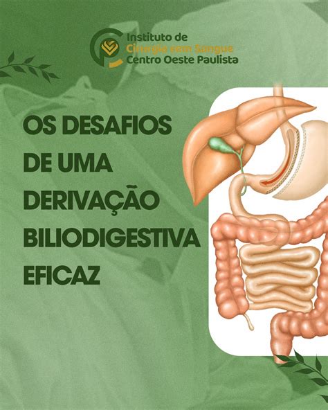 Os Desafios De Uma Deriva O Biliodigestiva Eficaz Instituto Cirurgia