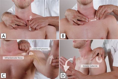 Please Confirm Mispend Response Rotator Cuff Palpation Spin Dated Belongs