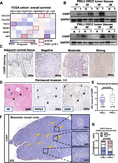 The Nociceptor Marker Calcitonin Gene Related Peptide CGRP Was