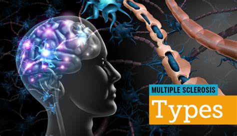 Types of MS: Understanding the Stages of MS | MyMSTeam