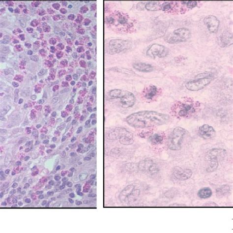 Langerhans Cells Histology