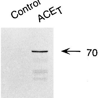 Expression Of Ace T In E Coli Total Cellular Protein Isolated From E