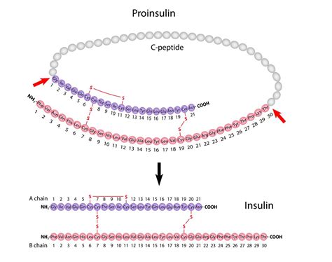 Hypoglycemia Workup My Endo Consult