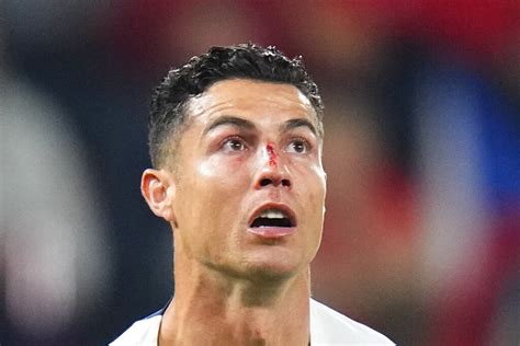 Video El Duro Golpe Que Sufrió Cristiano Ronaldo En El Triunfo De Portugal Diario Río Negro