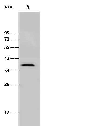 Podoplanin Antibody Guideline Sino Biological