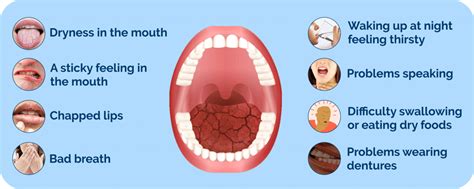 Drymouthpro Instant Dry Mouth Relief