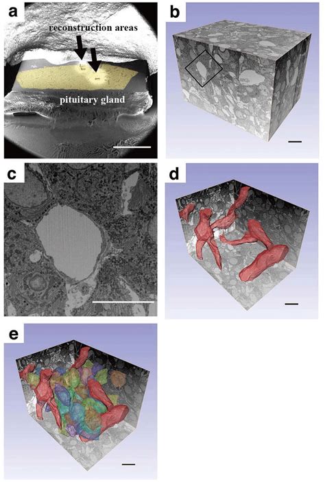 Three Dimensional Fib Sem Tomography Reconstruction Of The Anterior