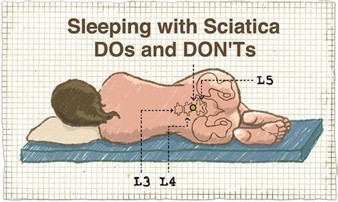 Sleeping With Sciatica Dos And Donts The Health Science Journal