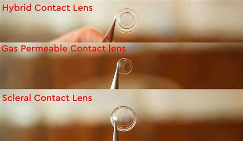 Keratoconus Contact Lenses