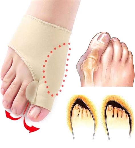 Bunion Corrector And Orthopedic Hallux Valgus Relief Splint Gel Bunion