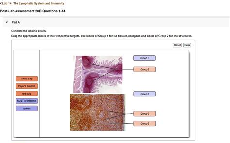 Solved Lab 14 The Lymphatic System And Immunity Post Lab Assessment 20b Questions 1 14 Part A