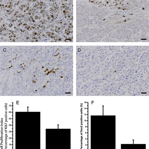 Expression Sox2 And Cell Proliferation In Xenografts With