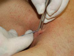 Bulgarian Female Genital Piercing Porn Pictures XXX Photos Sex