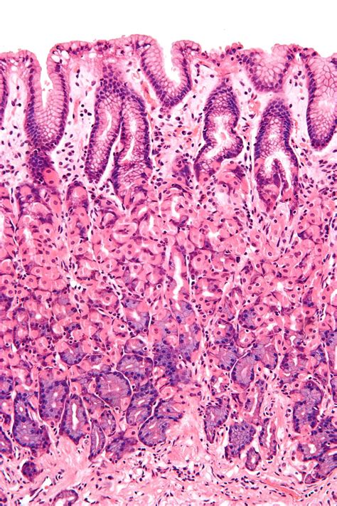 Simple columnar epithelium - Wikipedia