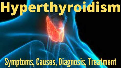 Hyperthyroidism Symptoms Causes Treatment And Diagnosis