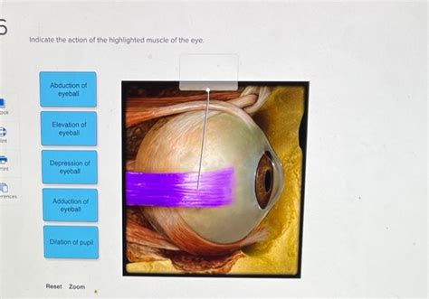 Solved Indicate The Action Of The Highlighted Muscle Of The Chegg