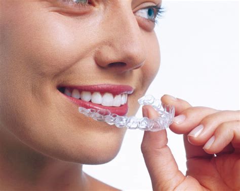 Invisible Tooth Straightening Invisalign Richmond Road Dental