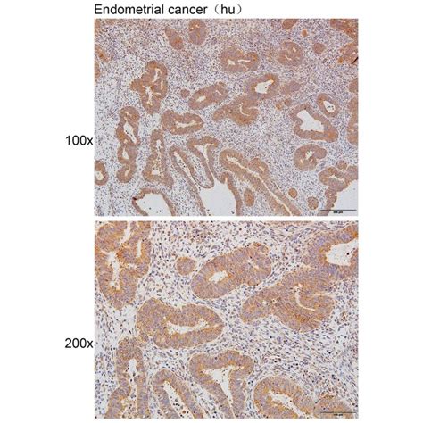 Solarbio K P Anti Mmp Polyclonal Antibody