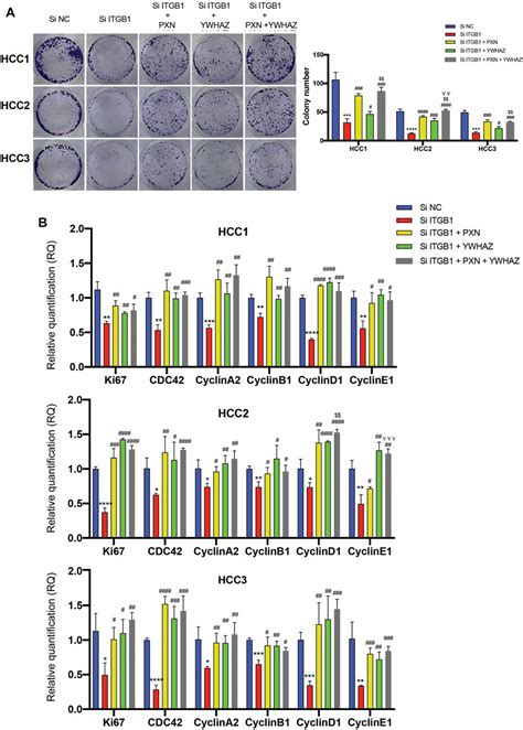 Frontiers ITGB1 Drives Hepatocellular Carcinoma Progression By