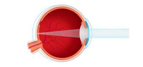 understanding  prescription parrelli optical