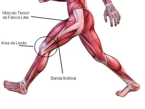 Optima Fisioterapia S Ndrome Da Banda Liotibial Trato Liotibial