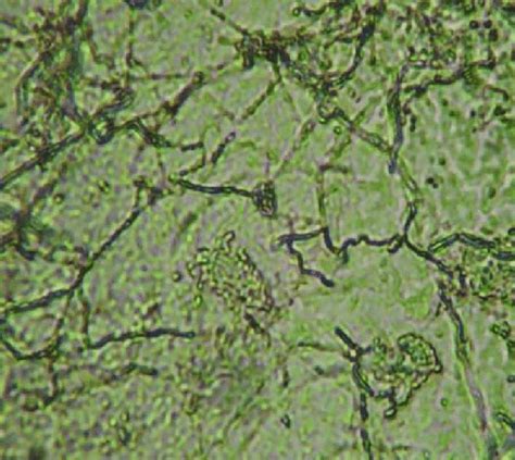 Spore Chain Morphology Of Isolate Kmfa 1 Under 400× Magnification