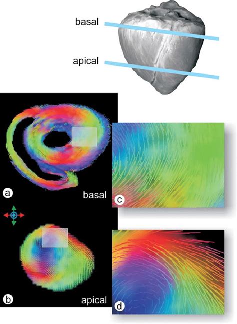 Short Axis SA Slices Taken At Basal A And Apical B Levels Of The