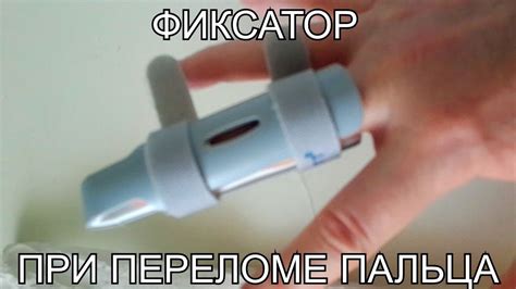 Перелом пальца руки/ Фиксатор - YouTube