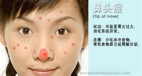 Acne And Health What Your Body Is Trying To Tell You With Acne4 Pimple Nose Tip