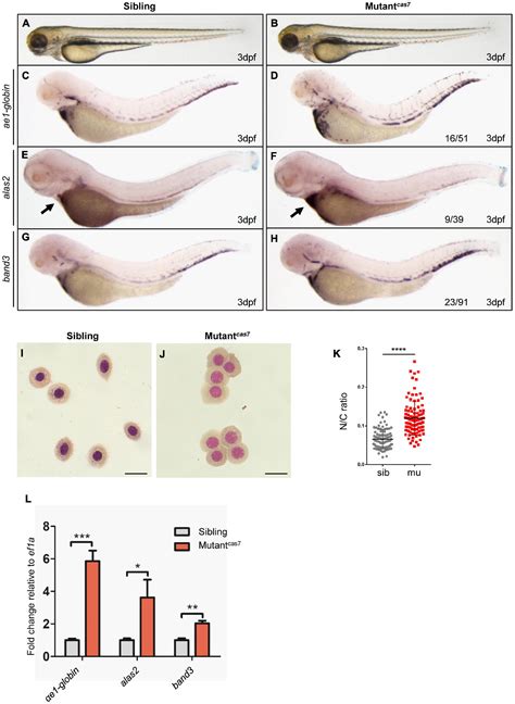 Frontiers Tpr Deficiency Disrupts Erythroid Maturation With Impaired