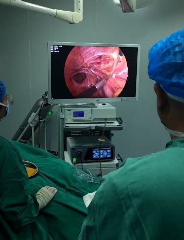 K Cmos Endoscope Camera System For Minimally Invasive Surgery China