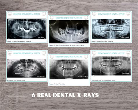 Dentist Dramatic Play Printable Dentist Office Pretend Play Classroom