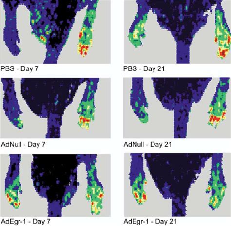 Laser Doppler Perfusion Imaging At Days 7 And 21 After Excision Low Or