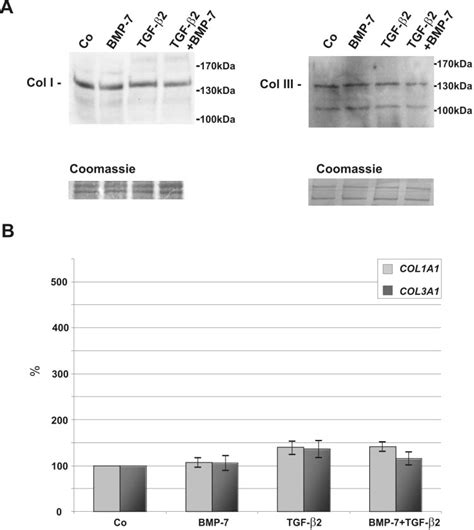 Western Blot For Collagen Types I And Iii Col I And Col Iii A And Download Scientific