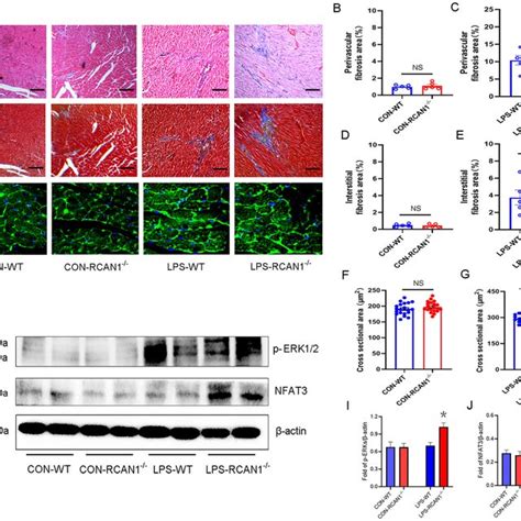 LPS Induced Cardiac Hypertrophy And Perivascular Fibrosis Were Enhanced