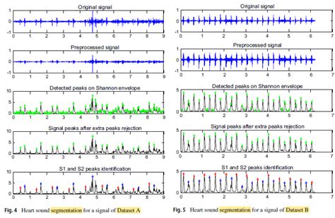 Brief Review — Phonocardiogram Signals Processing Approach for PASCAL Classifying Heart Sounds ...