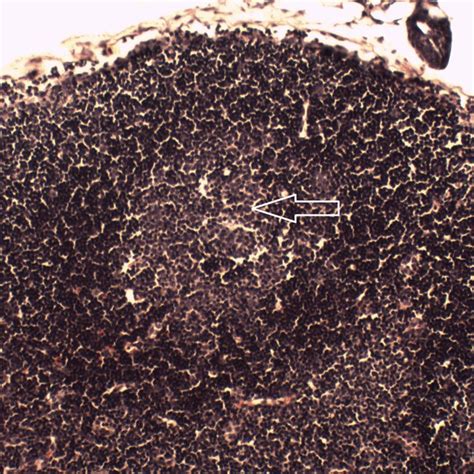 Hematoxylin And Eosin Staining Of The Lymph Node Lymph Node Cortex Of