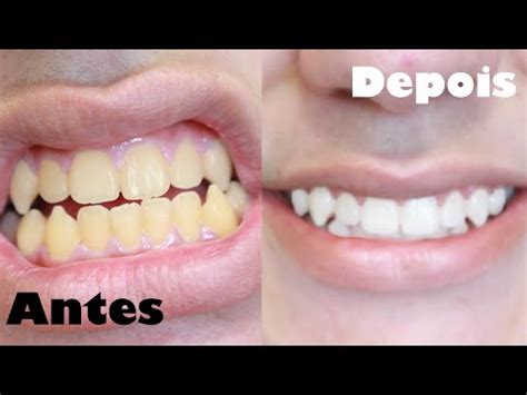 COMO CLAREAR OS DENTES EM 1 MINUTO RECEITA CASEIRA YouTube